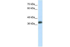 Human MCF-7; WB Suggested Anti-SAP30BP Antibody Titration: 0. (SAP30BP Antikörper  (C-Term))