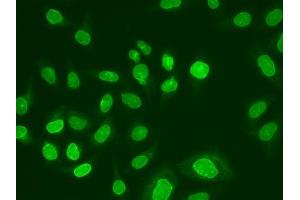 Immunofluorescence analysis of A549 cells using UBE2V1 antibody.