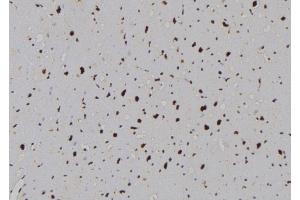 ABIN6264280 and ABIN6276989 at 1/100 staining Human heart tissue by IHC-P. (Phospholipase C beta 1 Antikörper  (Internal Region))