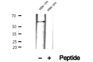 Western blot analysis of extracts of HEK-293 cells, using GEFT antibody. (ARHGEF25/GEFT Antikörper  (Internal Region))