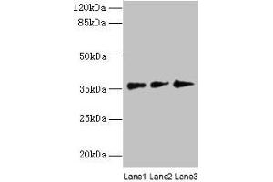 Western blot All lanes: LDAH antibody at 8 μg/mL Lane 1: Hela whole cell lysate Lane 2: Jurkat whole cell lysate Lane 3: A431 whole cell lysate Secondary Goat polyclonal to rabbit IgG at 1/10000 dilution Predicted band size: 38, 33, 23 kDa Observed band size: 38 kDa (LDAH/C2orf43 Antikörper  (AA 1-325))