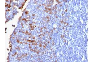 Formalin-fixed, paraffin-embedded human Tonsil stained with IgG Rabbit Recombinant Monoclonal Antibody (IG1707R). (Rekombinanter IGHG Antikörper)