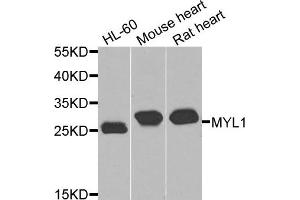 Western blot analysis of extracts of various cells, using MYL1 antibody. (MYL1 Antikörper)