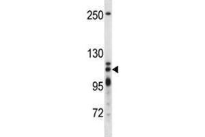 XRN2 antibody western blot analysis in T47D lysate (XRN2 Antikörper  (AA 48-76))