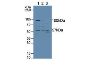 Western blot analysis of (1) Human HeLa cells, (2) Human A431 Cells and (3) Human Liver Tissue. (ALT Antikörper  (AA 255-496))