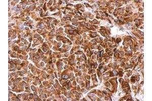 Immunohistochemistry (IHC) image for anti-Signal-Induced Proliferation-Associated 1 (SIPA1) (C-Term) antibody (ABIN2855951)