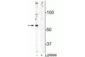 Western blot of mouse hippocampal lysate showing specific immunolabeling of the ~65 kDa Munc18-1 protein phosphorylated at Ser241 in the first lane (-). (STXBP1 Antikörper  (pSer241))