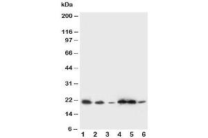 Western blot testing of SSR3 antibody and Lane 1:  rat liver (SSR3 Antikörper  (AA 8-23))