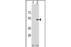 Western blot analysis of PLEKHA1 (arrow) using rabbit polyclonal PLEKHA1 Antibody (Center) (ABIN1537877 and ABIN2849727). (PLEKHA1 Antikörper  (AA 149-178))