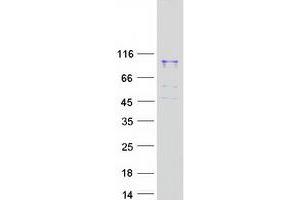 Validation with Western Blot (MACC1 Protein (Myc-DYKDDDDK Tag))