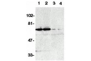 Western Blotting (WB) image for anti-Tumor Necrosis Factor Receptor Superfamily, Member 21 (TNFRSF21) antibody (ABIN1031729) (TNFRSF21 Antikörper)