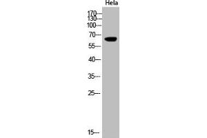 Western Blot analysis of Hela cells using Acetyl-Cytokeratin-pan (K194) Polyclonal Antibody (KRT2/KRT76/KRT3/KRT5/KRT6A/KRT6B/KRT6C/KRT71/KRT72/KRT73/KRT74/KRT75/KRT79/KRT7/KRT8/KRT84 (acLys194) Antikörper)