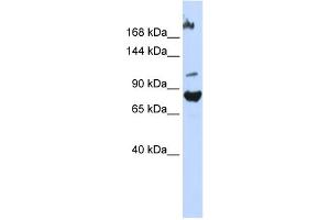 WB Suggested Anti-FBXO11 Antibody Titration:  0. (FBXO11 Antikörper  (Middle Region))