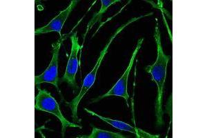 Immunofluorescence analysis of SK-BR-3 cells using PTH1R mouse mAb (green). (PTH1R Antikörper)