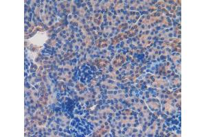 Used in DAB staining on fromalin fixed paraffin-embedded Kidney tissue (CD166 Antikörper  (AA 28-527))