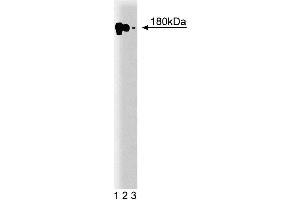Western blot analysis of EFG-R on A431 cell lysate. (EGFR Antikörper  (AA 1020-1046))