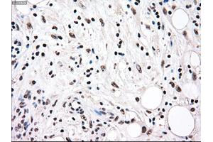 Immunohistochemical staining of paraffin-embedded colon tissue using anti-RAD9Amouse monoclonal antibody. (RAD9A Antikörper)