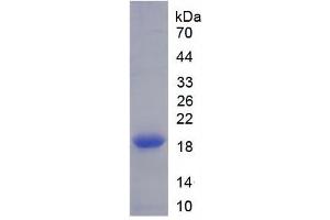 SDS-PAGE of Protein Standard from the Kit (Highly purified E.