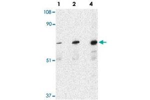Western blot analysis of PAK6 in Raji lysate with PAK6 polyclonal antibody  at 1, 2, and 4 ug/mL . (PAK6 Antikörper  (Internal Region))