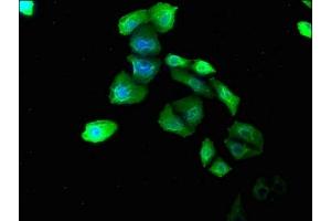 Immunofluorescence staining of Hela cells with ABIN7139783 at 1:180, counter-stained with DAPI. (COL6A1 Antikörper  (AA 64-80))
