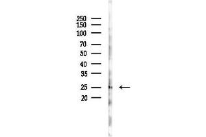 anti-Coiled-Coil Domain Containing 43 (CCDC43) antibody