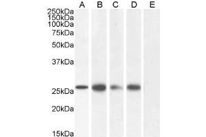 GJB2 Antikörper  (C-Term)