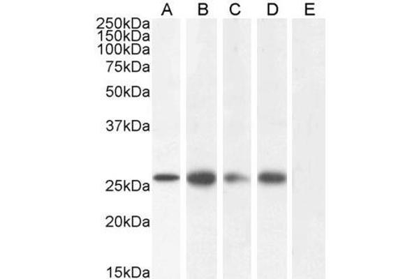 GJB2 Antikörper  (C-Term)