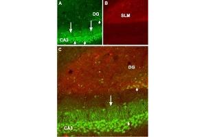 Expression of GABA(B) receptor 1 in mouse hippocampus - Immunohistochemical staining of mouse hippocampus frozen sections using Anti-GABA(B) R1 (extracellular) Antibody (ABIN7043195, ABIN7044319 and ABIN7044320), (1:100). (GABBR1 Antikörper  (Extracellular))