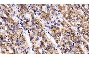 Immunohistochemistry (IHC) image for anti-Baculoviral IAP Repeat-Containing 5 (BIRC5) (AA 1-142) antibody (ABIN7426451)