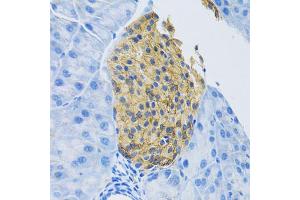 Immunohistochemistry of paraffin-embedded mouse pancreas using SLC1A2 antibody (ABIN5995519) at dilution of 1/100 (40x lens). (SLC1A2 Antikörper)