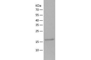 Western Blotting (WB) image for Sclerostin (SOST) (AA 24-213) protein (His tag) (ABIN7124988) (Sclerostin Protein (SOST) (AA 24-213) (His tag))