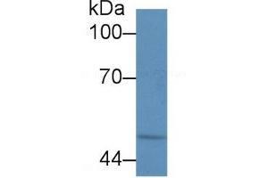 Western Blotting (WB) image for Calreticulin (CALR) ELISA Kit (ABIN6574281)