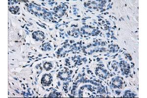 Immunohistochemical staining of paraffin-embedded breast tissue using anti-SORD mouse monoclonal antibody. (SORD Antikörper)
