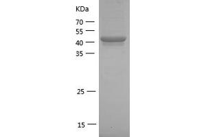 Western Blotting (WB) image for Interleukin-1 Receptor-Associated Kinase 1 (IRAK1) (AA 504-712) protein (GST tag) (ABIN7281787) (IRAK1 Protein (AA 504-712) (GST tag))