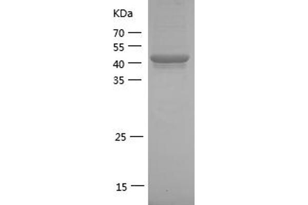 IRAK1 Protein (AA 504-712) (GST tag)