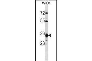 Western blot analysis in WiDr cell line lysates (35ug/lane). (HMGCL Antikörper  (AA 161-190))