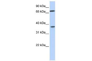 MAP2K3 antibody used at 1 ug/ml to detect target protein. (MAP2K3 Antikörper  (C-Term))