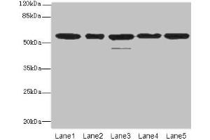 Western blot All lanes: RBBP4 antibody at 1 μg/mL Lane 1: Hela whole cell lysate Lane 2: LO2 whole cell lysate Lane 3: K562 whole cell lysate Lane 4: NIH/3T3 whole cell lysate Lane 5: Raji whole cell lysate Secondary Goat polyclonal to rabbit IgG at 1/10000 dilution Predicted band size: 48, 47, 44 kDa Observed band size: 48, 55 kDa (Retinoblastoma Binding Protein 4 Antikörper  (AA 246-425))