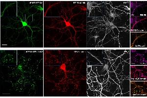 Effect of Shank3 on localization of δ-catenin in neurons. (MAP2 Antikörper)