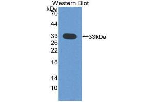 Western Blotting (WB) image for anti-Cyclin-Dependent Kinase 4 (CDK4) (AA 6-295) antibody (ABIN1858347) (CDK4 Antikörper  (AA 6-295))