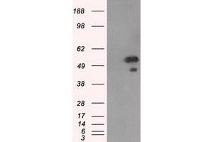 Western Blotting (WB) image for anti-SHC (Src Homology 2 Domain Containing) Transforming Protein 1 (SHC1) antibody (ABIN1499993) (SHC1 Antikörper)