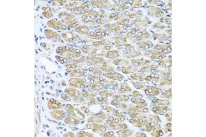 Immunohistochemistry of paraffin-embedded mouse stomach using RAC2 antibody (ABIN5970487) at dilution of 1/100 (40x lens). (RAC2 Antikörper)