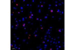 Immunofluorescence (Paraffin-embedded Sections) (IF (p)) image for anti-Microtubule-Associated Protein 7 (MAP7) antibody (ABIN7074621)