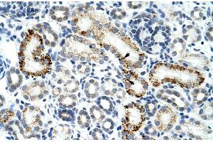 Human Kidney; Rabbit Anti-ZESR2 Antibody. (ZRSR2 Antikörper  (C-Term))