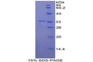 SDS-PAGE analysis of Human Contactin 1 Protein. (Contactin 1 Protein (CNTN1))