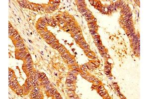 Immunohistochemistry (IHC) image for anti-serpin Peptidase Inhibitor, Clade B (Ovalbumin), Member 1 (SERPINB1) (AA 1-379) antibody (ABIN7158247)
