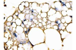 IHC analysis of FABP4 using anti-FABP4 antibody (ABIN7603145).