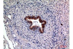 Immunohistochemistry (IHC) analysis of paraffin-embedded Human Liver, antibody was diluted at 1:100.