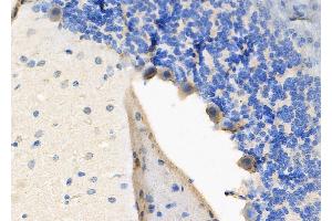 ABIN6266103 and ABIN6278312 at 1/100 staining Rat brain tissue by IHC-P. (ZFYVE9 Antikörper  (C-Term))