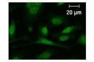 Immunostaining analysis in HeLa cells. (c-FOS Antikörper)